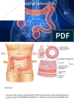 Cancerul colorectal