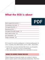 ECG Made Easy