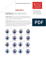 Understanding the Brain Differences in ADHD