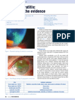 Herpetic Keratitis A Review