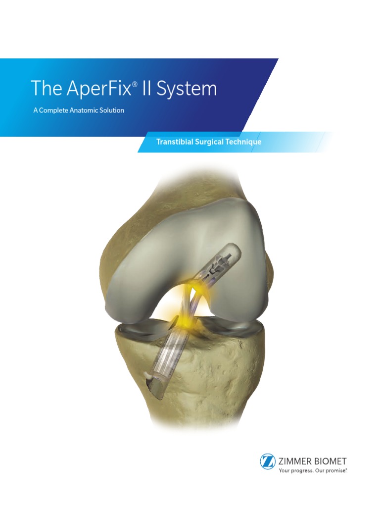1477.1-GLBL-en AperFix II Transtibial SurgTech-DIGITAL | PDF ...