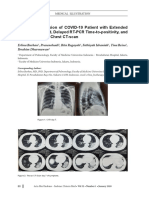 Clinical Progression of COVID-19 Patient With Extended Incubation Period, Delayed RT-PCR Time-To-Positivity, and Potential Role of Chest CT-scan