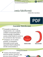 Anemia Falciformă