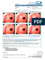 Endoscopia muestra reflujo y gastritis en paciente de 68 años