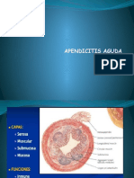 Apendicitis