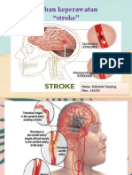 Ppt Stroke Edri