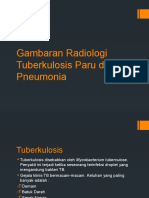 Gambaran Radiologi Tuberkulosis Paru Dan Pneumonia