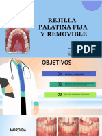 Rejilla Palatina Fija y Removible PDF