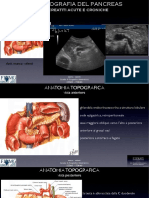 ETG Pancreas & Pancreatiti