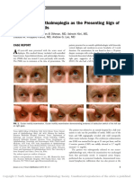 Internuclear Opthalmoplegia