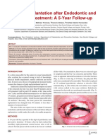 Delayed Replantation After Endodontic and Fluoride