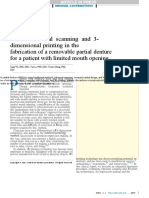 Use of Intraoral Scanning and 3-Dimensional Printing in The Fabrication of A Removable Partial Denture For A Patient With Limited Mouth Opening