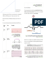 How to Interpret an ECG in Seven Steps