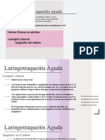 Laringotraqueitis