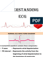 Understanding ECG Waveforms and Analyzing Rhythms