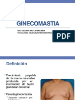 Ginecomastia 