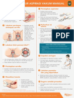 3 - Langkah Prosedur Aspirasi Vakum Manual