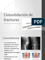 Consolidacion de Fracturas