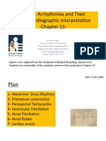 04. Chapter 13- Cardiac Arrhythmias and Their Electrocardiographic Interpretation