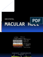 Macular Hole DR R PATEL