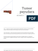 Tumor Payudara