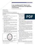 Basic Principles of Computed Tomography and Relevant Neuroanatomy