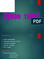 tumor tonsil