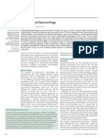 Subarachnoid Haemorrhage