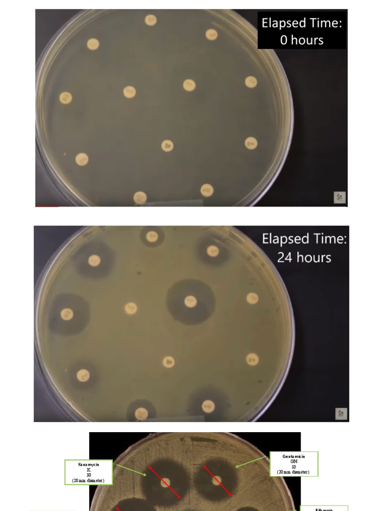 Kirby Bauer Lecture Material | PDF | Antibiotics | Biocides