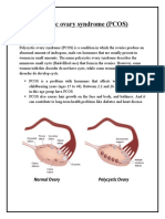 PCOS