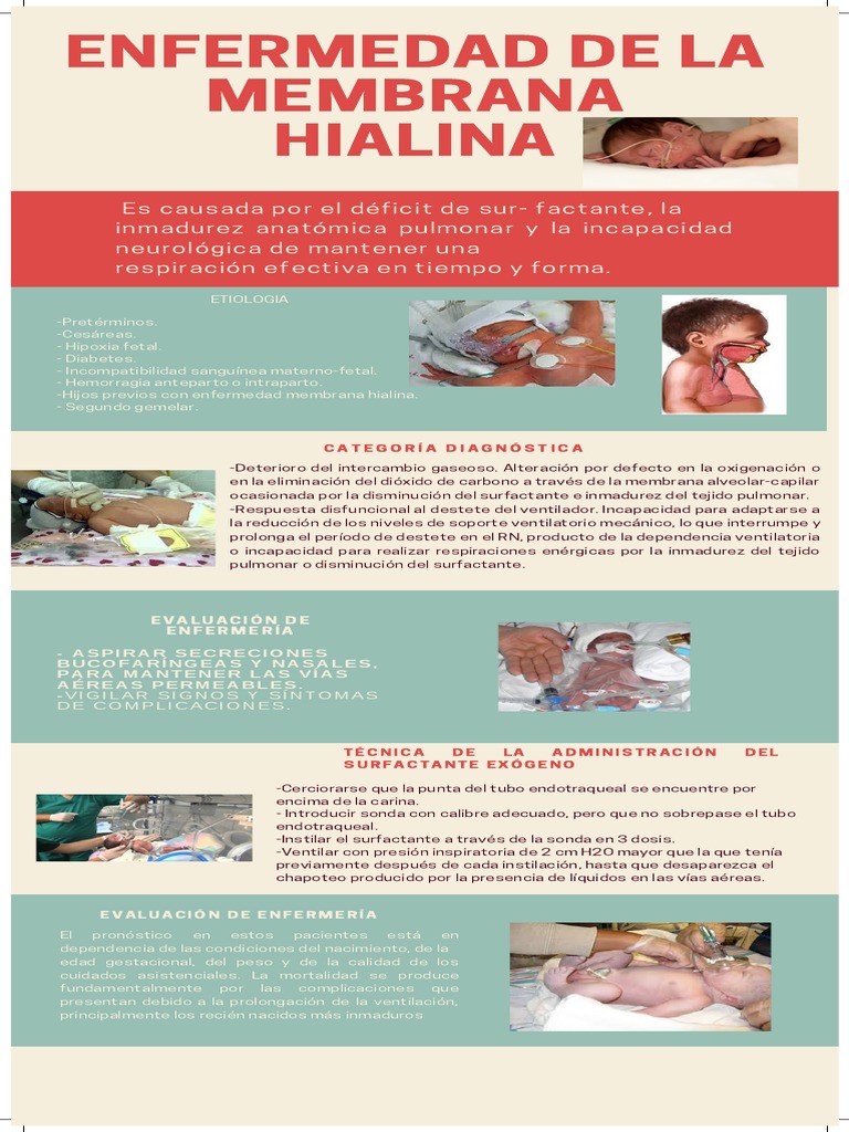 Enfermedad de La Membrana Hialina. PDF