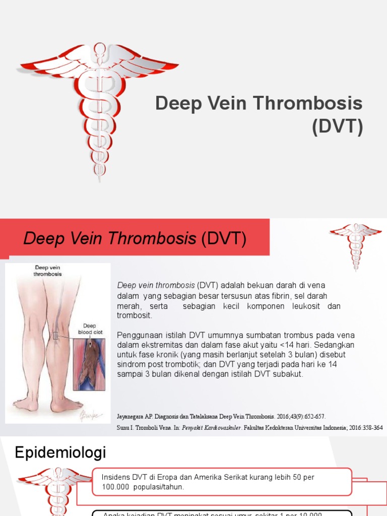 Pemahaman Deep Vein Thrombosis (DVT) | PDF | Sains & Matematika