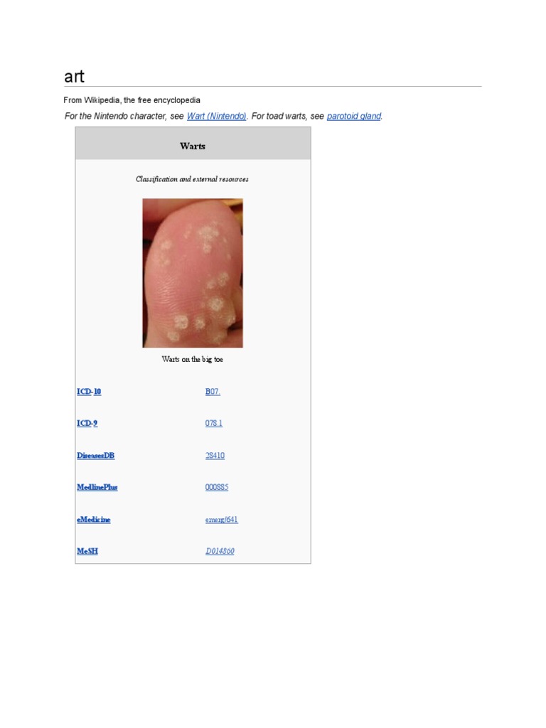 warts | Medicine | Medical Specialties