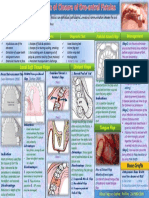 Local Soft Tissue Flaps Distant Flaps: Definition