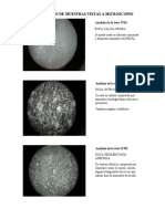 Descripción de Muestras Vistas A Microscopio