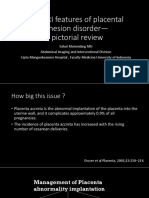 The MRI Features of Placental Adhesion Disorder—