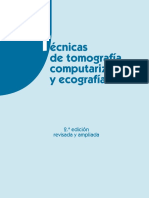 Técnicas de Tomografía Computarizada