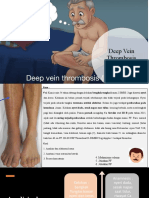 Deep Vein Thrombosis: by Chels