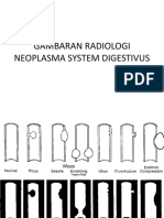 NEOPLASMA