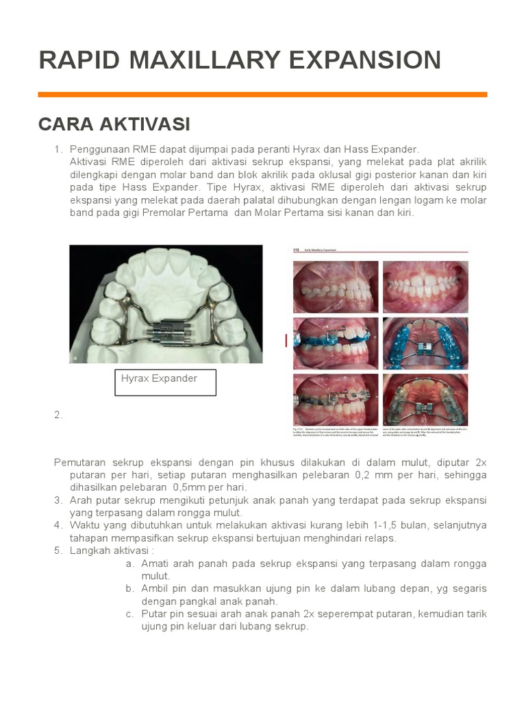 Aktivasi Ekspansi Maxillary Cepat | PDF