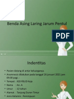 Benda Asing Laring 