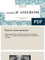 Aneurisma Aorta