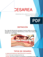 cesarea-180615193021