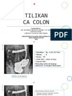 Tilikan CA Colon 