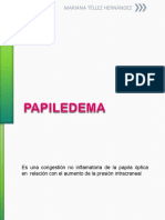 papiledemafinal-140529195708-phpapp02 (1)