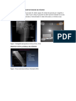 Proyección Radiologicas de Fémur y Cadera