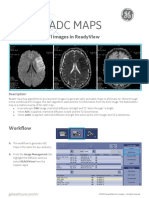 Adc & Eadc Maps: Processing The Dwi Images in Readyview