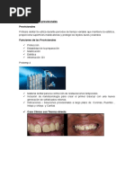 Banda Ansa: Mantenedor de Espacio Dental | PDF | Ortodoncia | Odontología