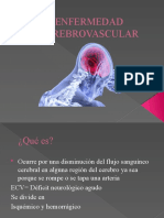 Enfermedad cerebrovascular: causas, síntomas y tratamientos