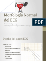 Morfología Normal Del ECG